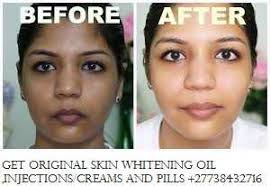 Permanent Skin Lightening Skin Whitening Products +277384327
