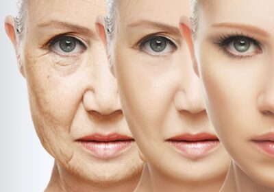 3-Solution-Ingredients-for-Aging-Skin