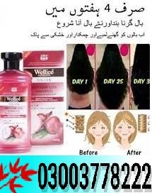 Anti Hair Loss onion Shampoo Price In Kasur- 03003778222