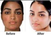 Skin lightening cream and pills call+256777422022