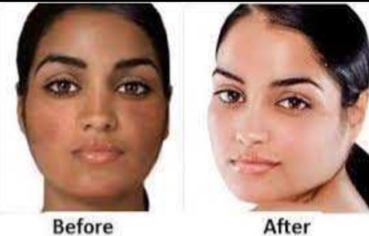 Skin lightening cream and pills call+256777422022