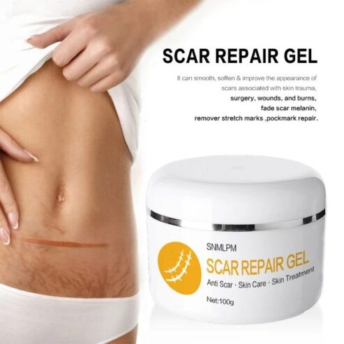 Snmlpm Scar Repair Gel Price In Pakistan