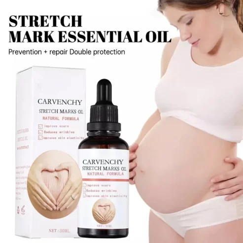 Carvanchey Strech Mark Oil Price In Pakistan Wellmart