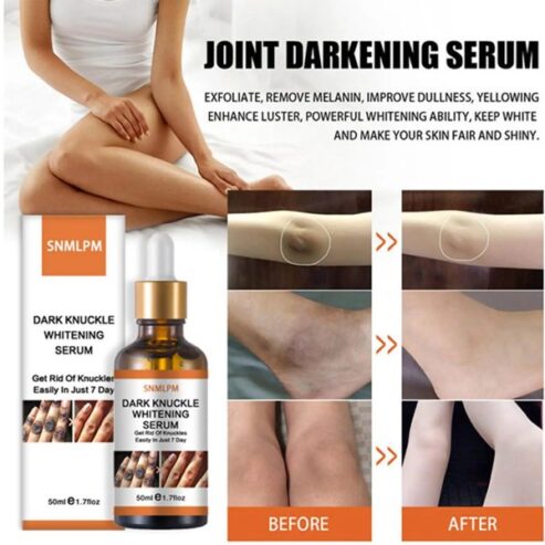 Snmlpm Dark Knuckles Whitening Serum Price In Pakistan